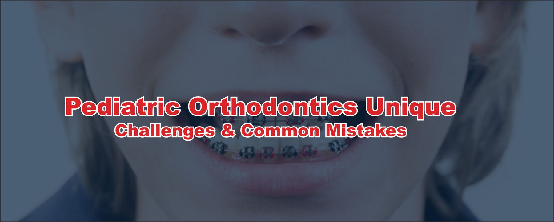 Pediatric Orthodontics: Unique Challenges & Common Mistakes