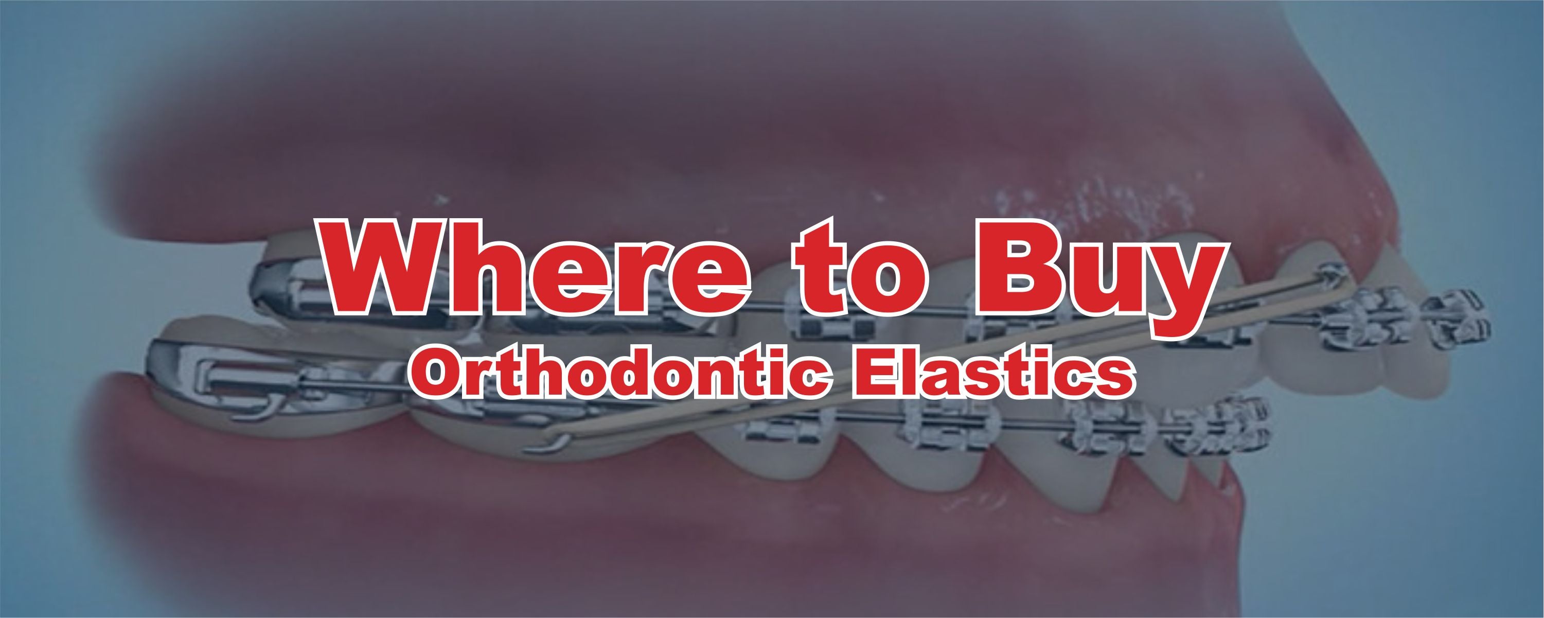 Where to Buy Orthodontic Elastics DDP Elite USA