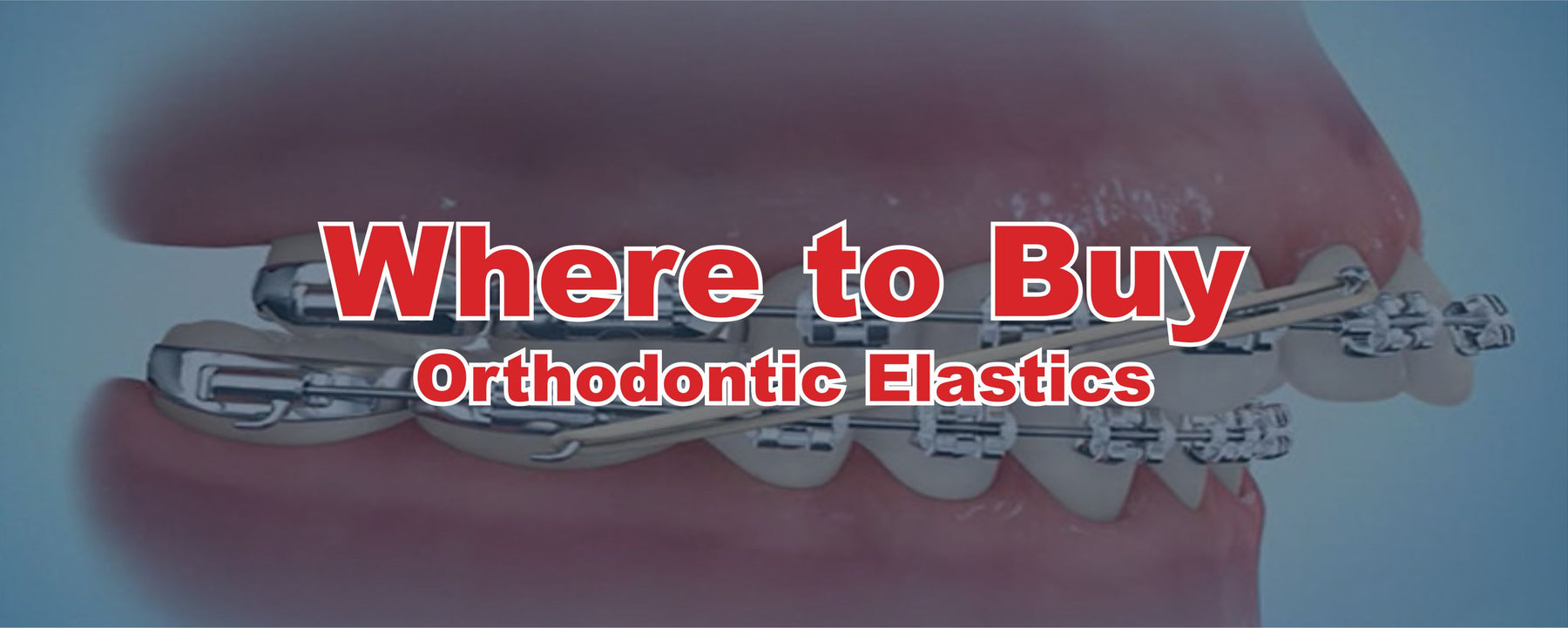 Where to Buy Orthodontic Elastics