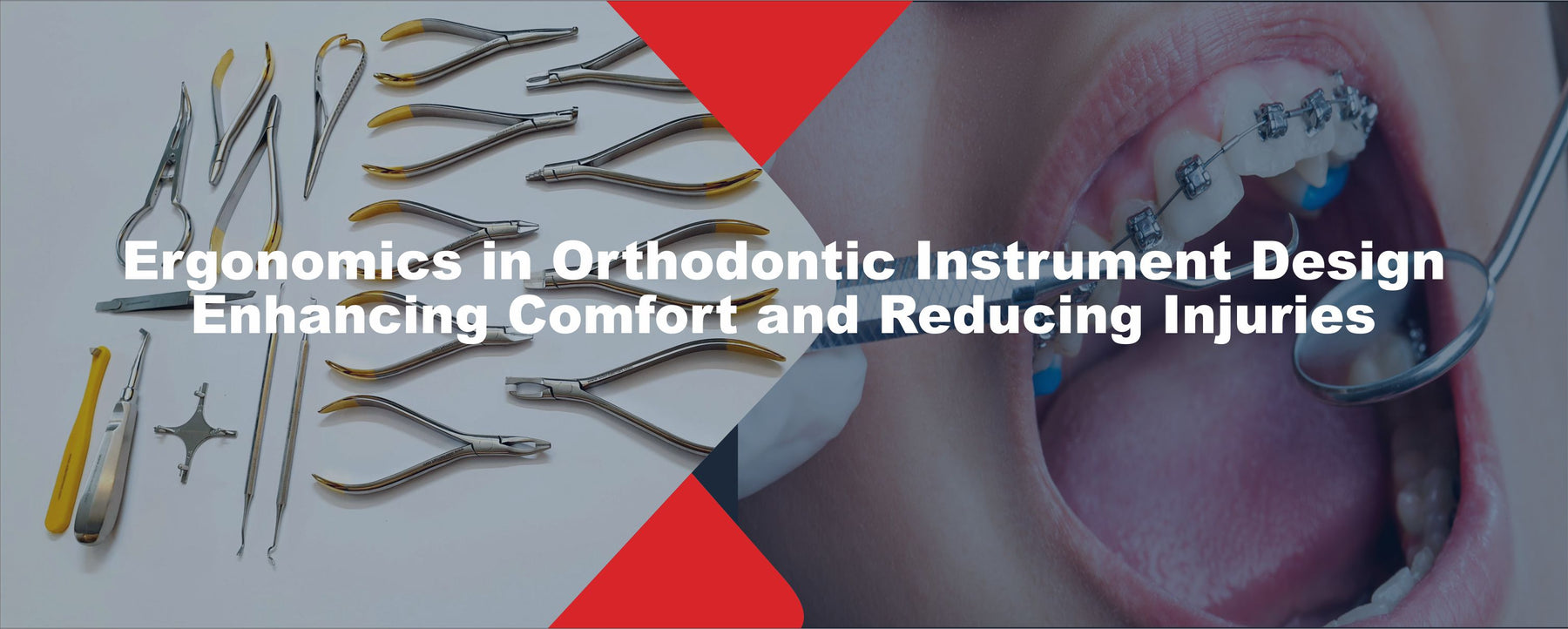 Ergonomics in Orthodontic Instrument Design: Enhancing Comfort and Reducing Injuries