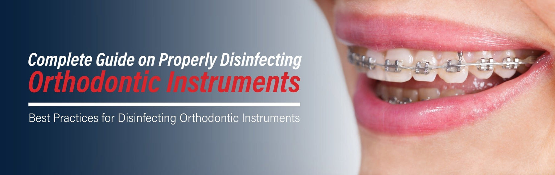 Complete Guide on Properly Disinfecting Orthodontic Instruments