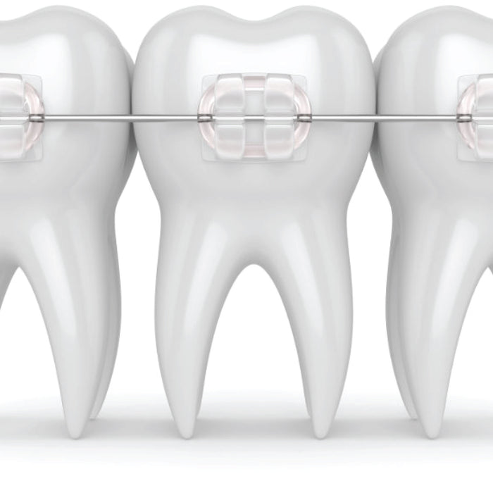 Essential Guide to Must-Have Orthodontic Instruments for Every Practice