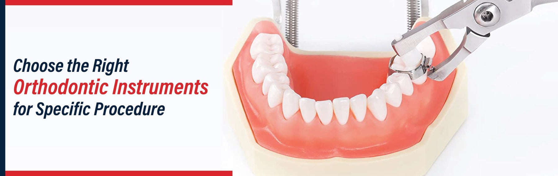 How to Choose the Right Orthodontic Instruments for Specific Procedures