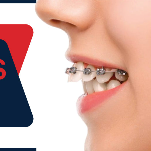 Why are braces placed high on teeth - DDP Elite USA