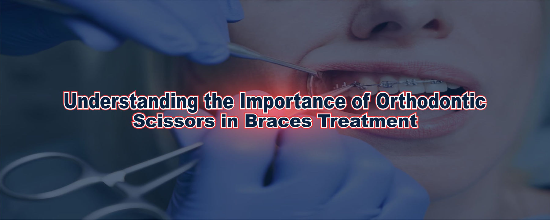 Understanding the Importance of Orthodontic Scissors in Braces Treatment