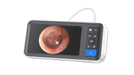 Teslong MS450-NTE Digital Otoscope