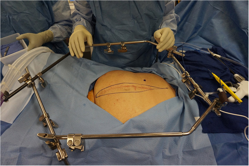 Surgical Retractors Set